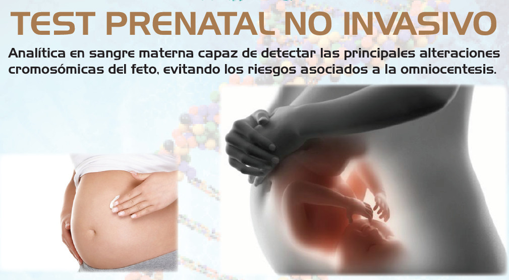 Test prenatal no invasivo